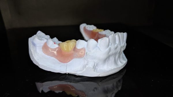 ceramdent