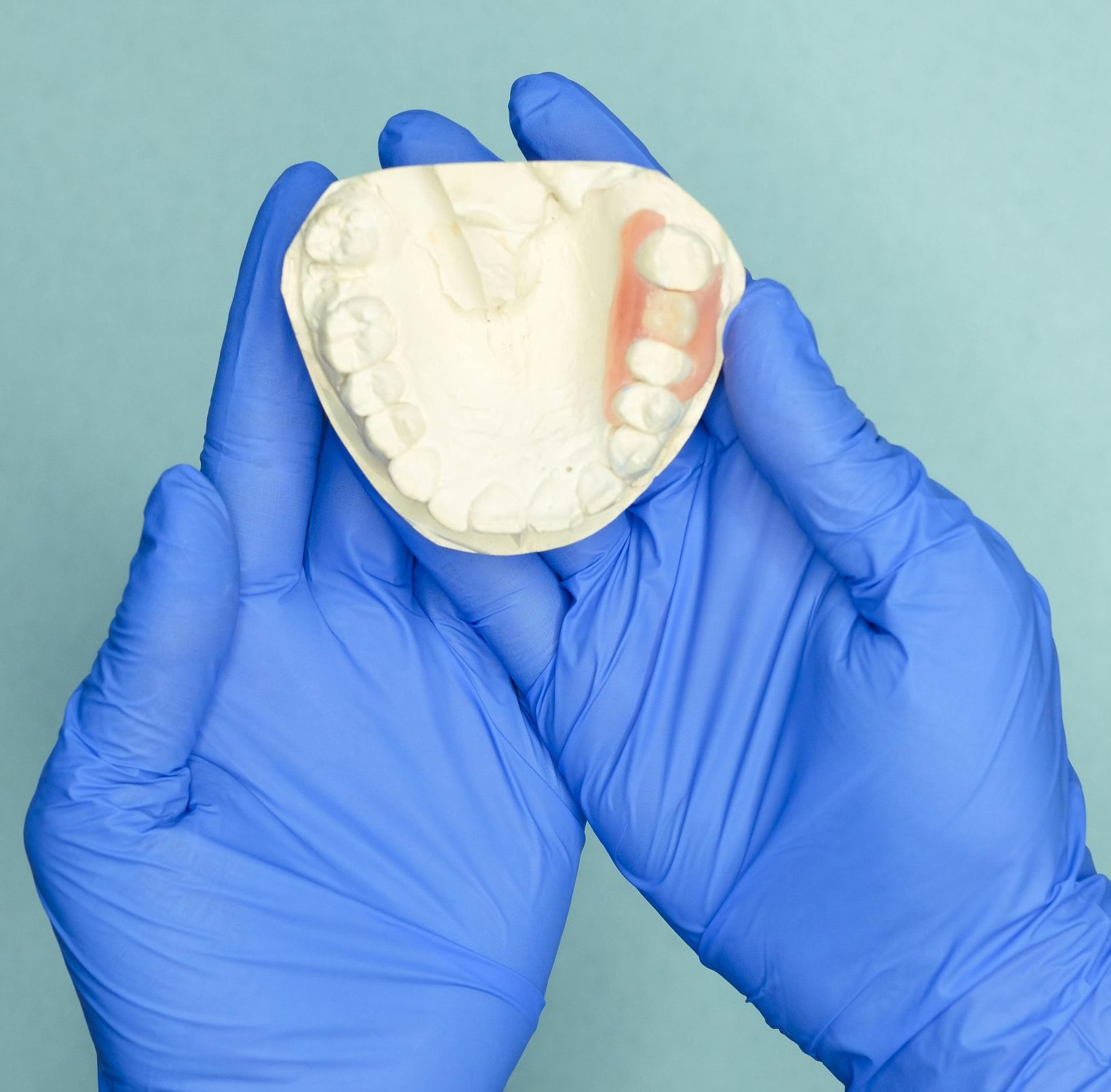 Denture